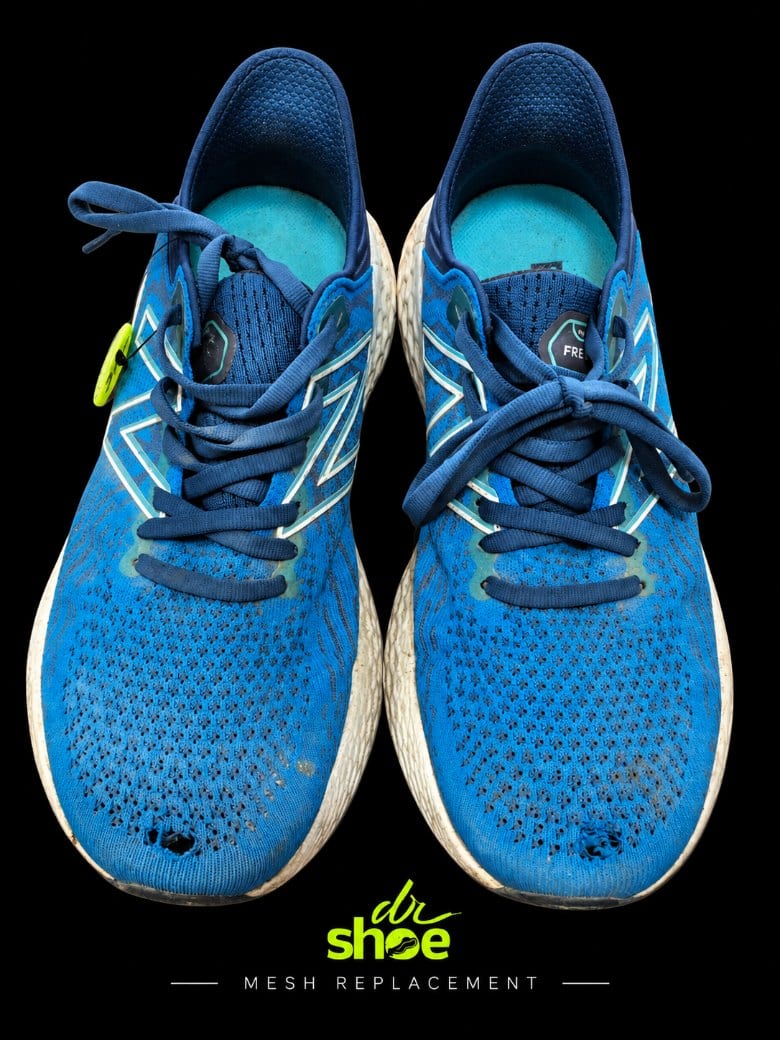 Blue New Balance runners worn through at both toe boxes